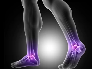 Premier Ortho Products PCD Company in India