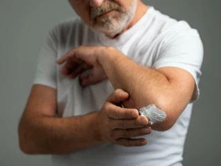 Top Antifungal Cream Franchise Companies in India